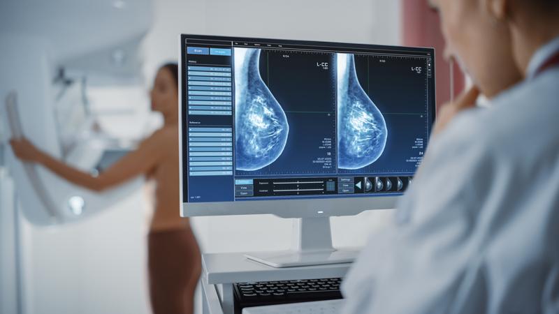 SVLFG/LKK: Ausweitung Mammographie-Screening